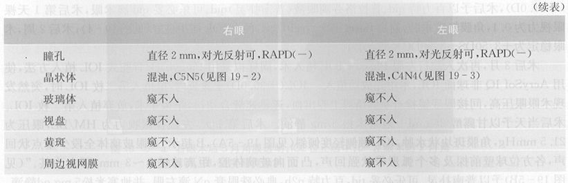 ZY016_95_1.gif